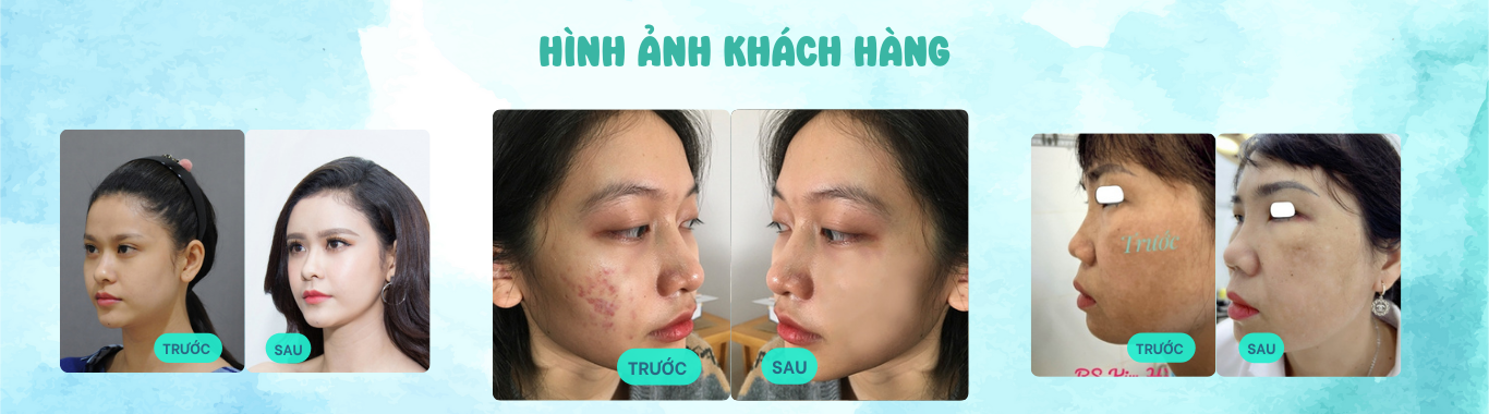 thẩm mỹ viện bác sĩ kim hà