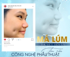 CÔNG NGHỆ PHẨU THUẬT MÁ LÚM TẠI LONG KHÁNH