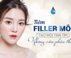 Những lưu ý cho bạn khi đi tiêm filler