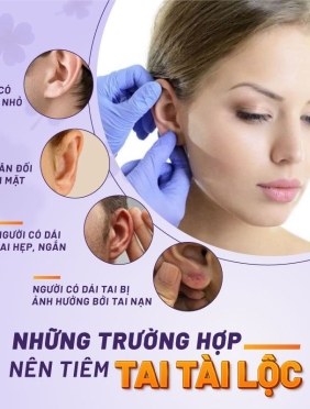 tạo hình tay phật, làm đầy trái tay